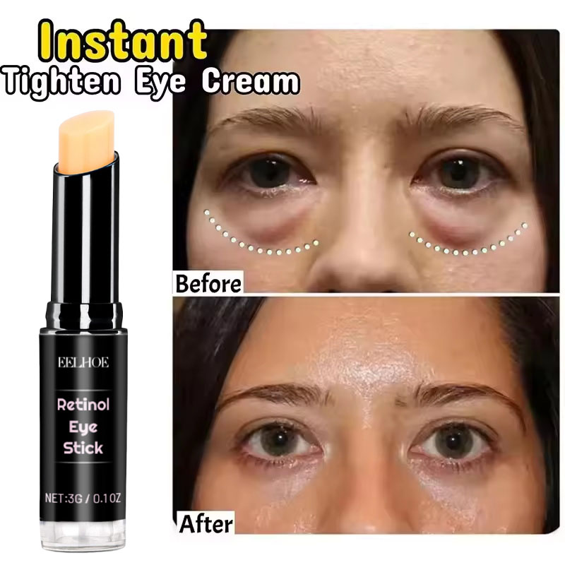 Milk Thistle Silymarin - Instant Eye Bag Remove Cream Retinol