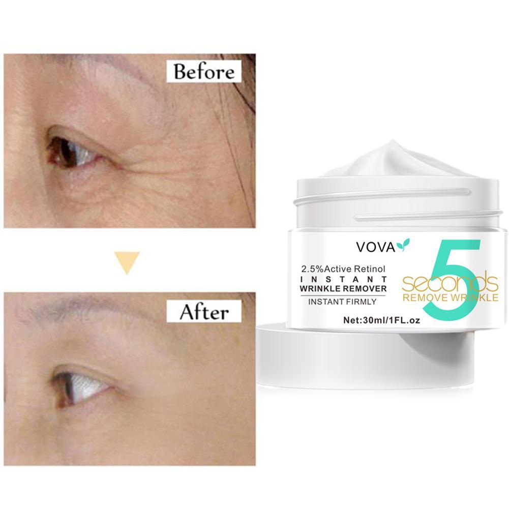 2.5% Active Retinol Eye Cream  - đánh giá và giá Milk Thistle Silymarin