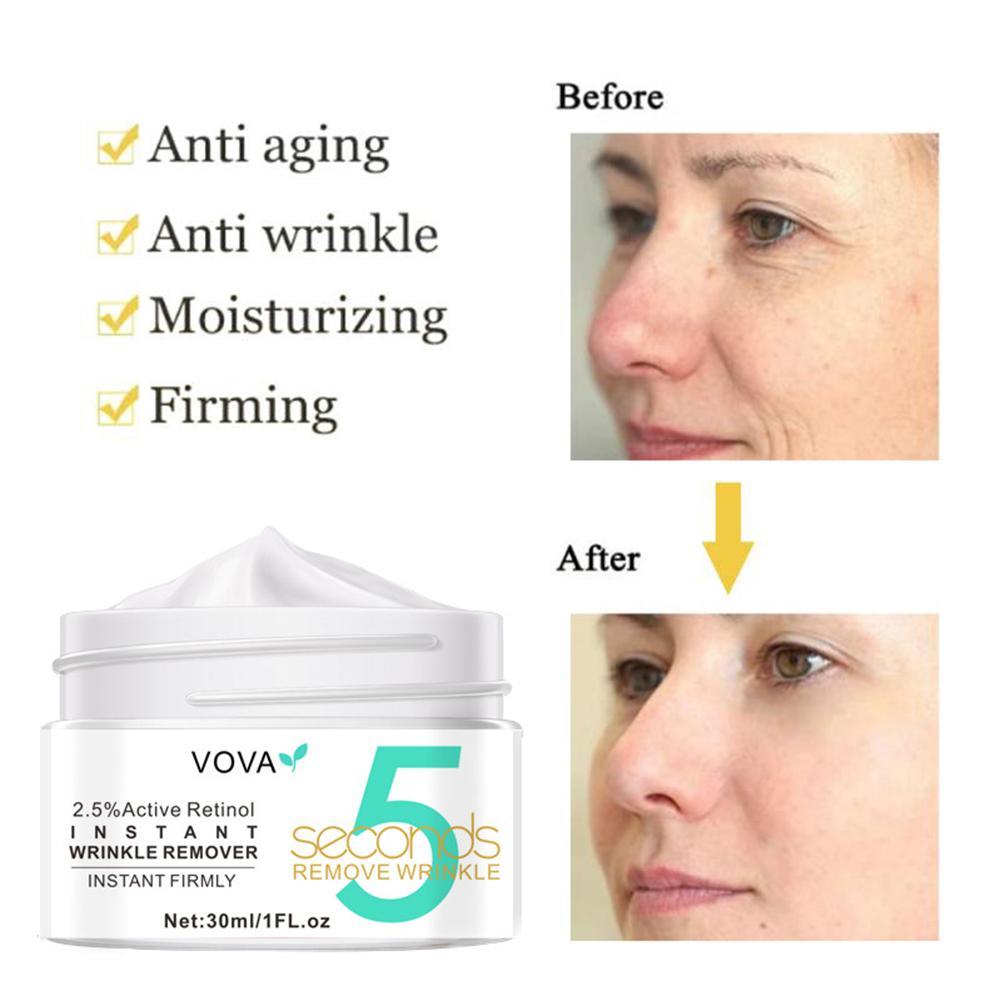 2.5% Active Retinol Eye Cream  - đánh giá và giá Milk Thistle Silymarin