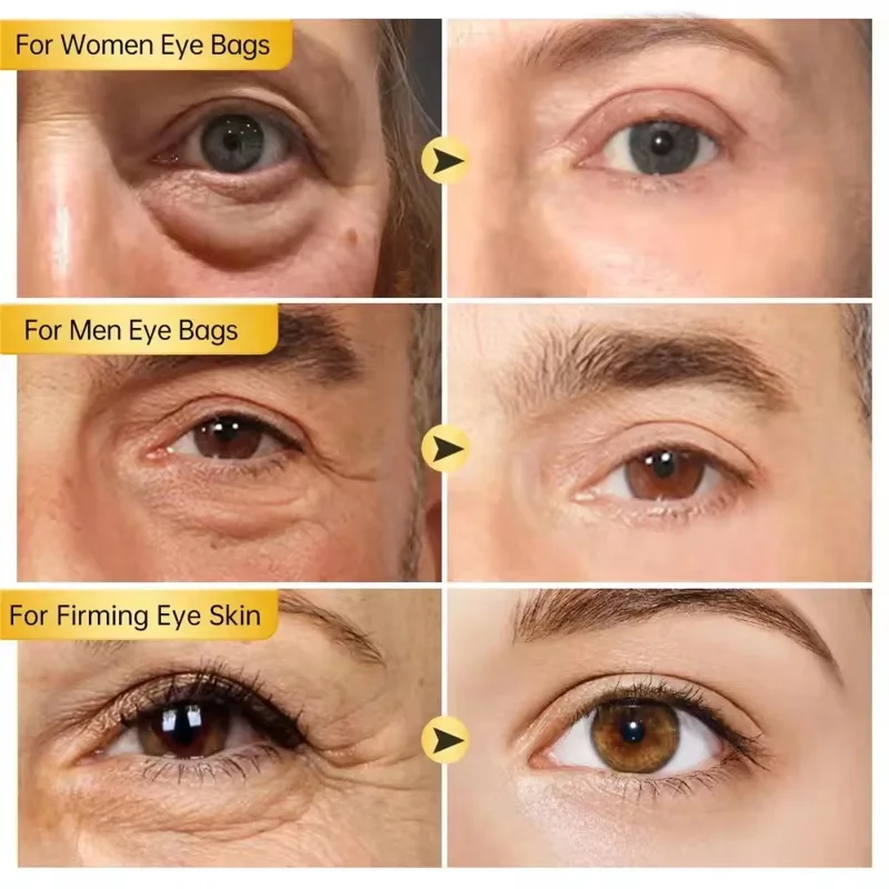 Instant Eye Bag Remove Cream R - đánh giá và giá Milk Thistle Silymarin