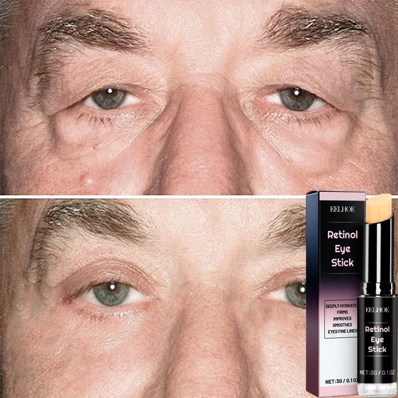 Instant Eye Bag Remove Cream R - đánh giá và giá Milk Thistle Silymarin