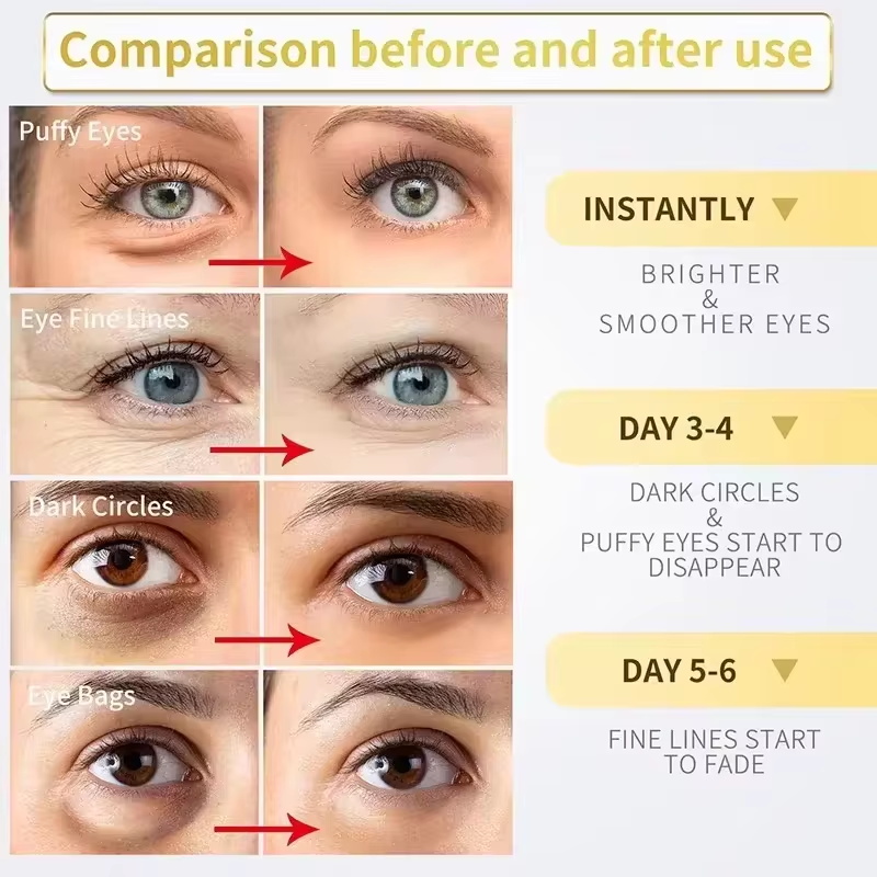 Instant Eye Bag Remove Cream R - đánh giá và giá Milk Thistle Silymarin