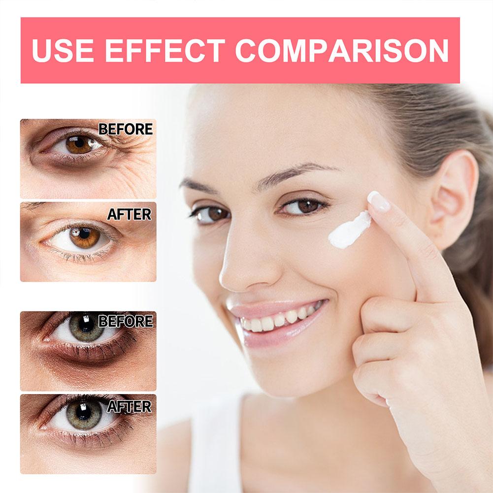 Retinol Eye Cream Lightening D - đánh giá và giá Milk Thistle Silymarin